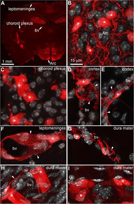 Leptin Receptor Expression in Mouse Intracranial Perivascular Cells